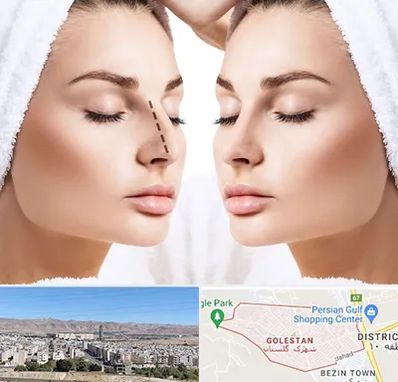 عمل بینی در شهرک گلستان شیراز