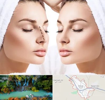 عمل بینی در دورود