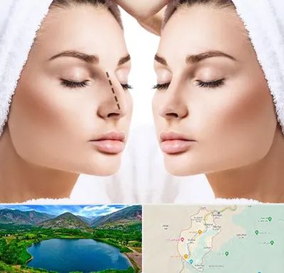 عمل بینی در رودبار