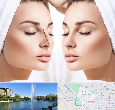 عمل بینی در کوهسنگی مشهد