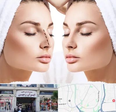 عمل بینی در ایران زمین