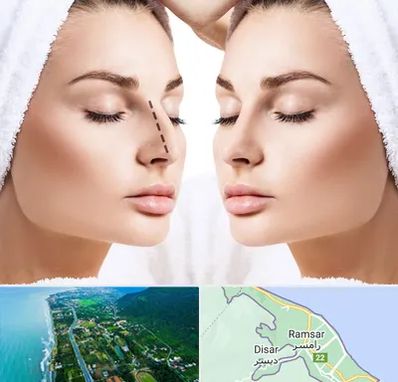 عمل بینی در رامسر