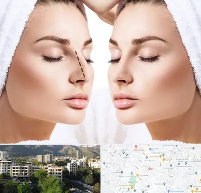 عمل بینی در دیباجی