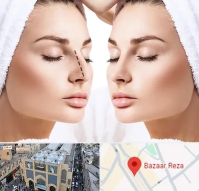 عمل بینی در بازار رضا مشهد