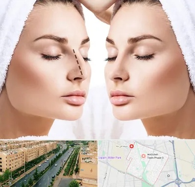 عمل بینی در فاز سه اندیشه