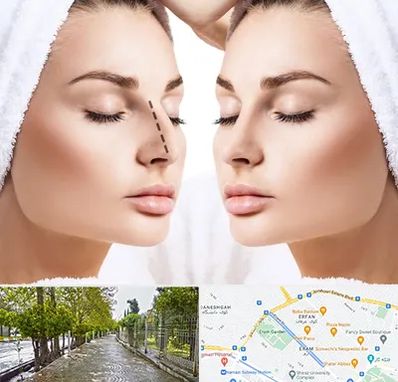 عمل بینی در خیابان ارم شیراز