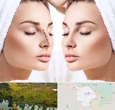 عمل بینی در بهبهان