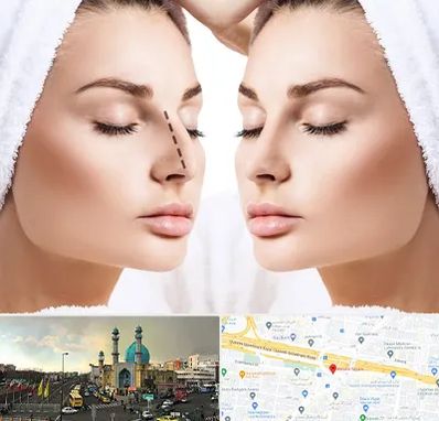 عمل بینی در رسالت