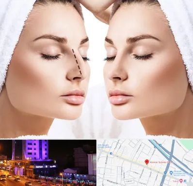 عمل بینی در آبرسان تبریز