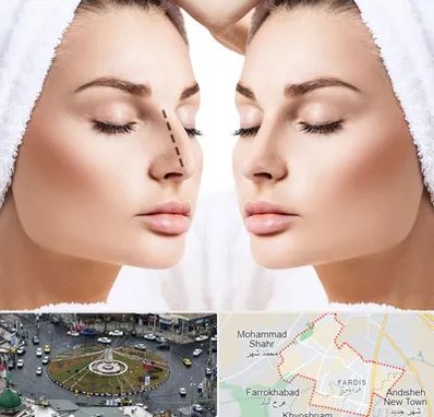 عمل بینی در فردیس کرج