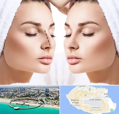 عمل بینی در کیش