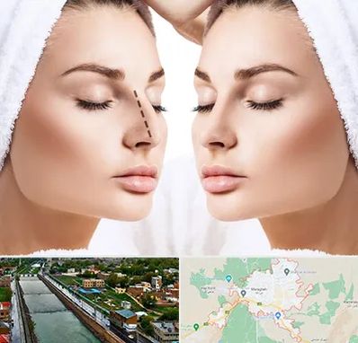 عمل بینی در مراغه