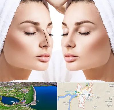 عمل بینی در مهاباد