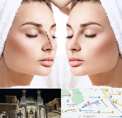 عمل بینی در زرگری شیراز