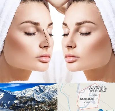 عمل بینی در شمشک