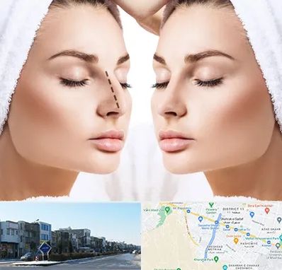 عمل بینی در شریعتی مشهد