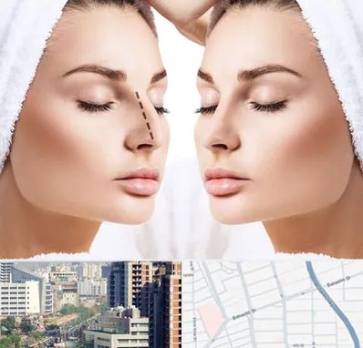عمل بینی در خیابان بهشتی