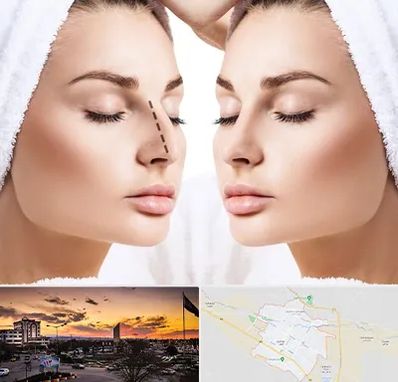 عمل بینی در قوچان