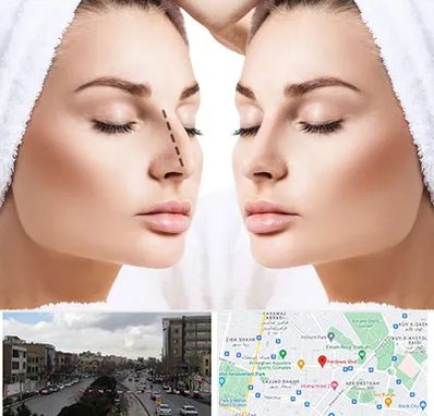 عمل بینی در بلوار فردوسی مشهد