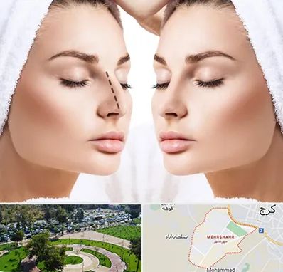 عمل بینی در مهرشهر کرج