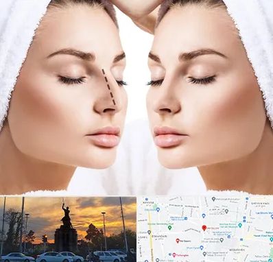 عمل بینی در میدان حر