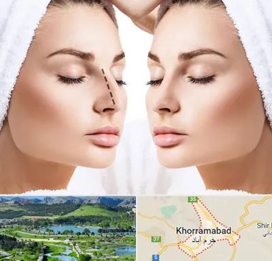 عمل بینی در خرم آباد