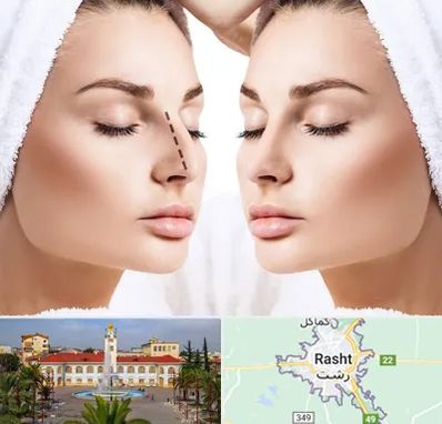 عمل بینی در رشت