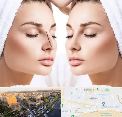 عمل بینی در تهرانپارس