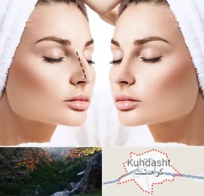 عمل بینی در کوهدشت