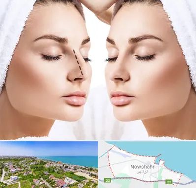 عمل بینی در نوشهر