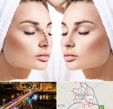 عمل بینی در سقز