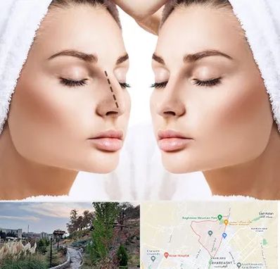 عمل بینی در باغستان کرج