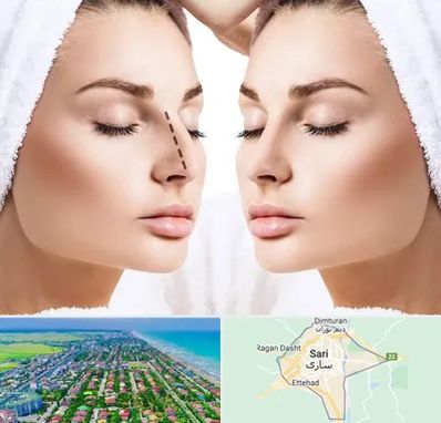 عمل بینی در ساری