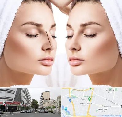 عمل بینی در بلوار فردوس