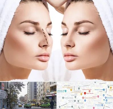 عمل بینی در فاطمی