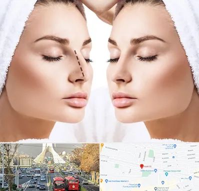 عمل بینی در خیابان آزادی