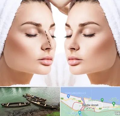 عمل بینی در بندر انزلی