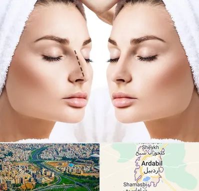 عمل بینی در اردبیل