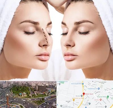 عمل بینی در سبلان