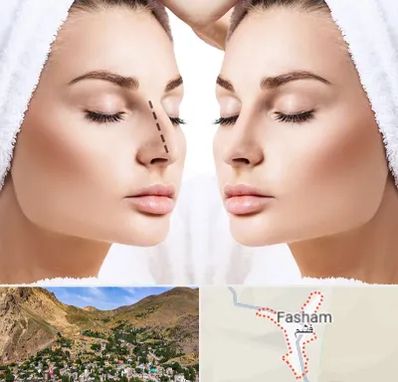 عمل بینی در فشم