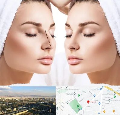 عمل بینی در هنگام