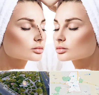 عمل بینی در کاشمر