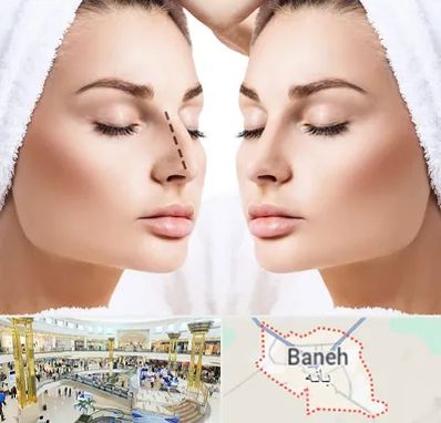 عمل بینی در بانه