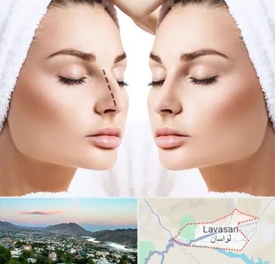 عمل بینی در لواسان