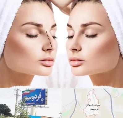 عمل بینی در فردوسیه شهریار