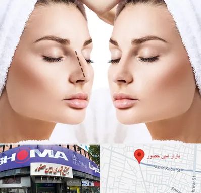 عمل بینی در امین حضور