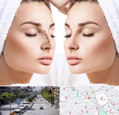 عمل بینی در خیابان زند شیراز