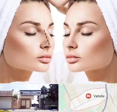 عمل بینی در وحیدیه شهریار