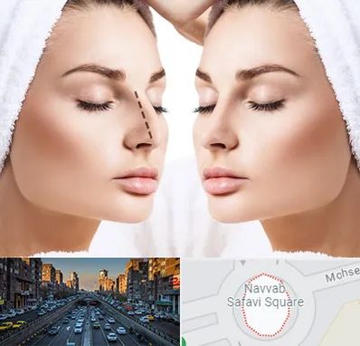 عمل بینی در نواب