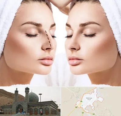 عمل بینی در شهرضا